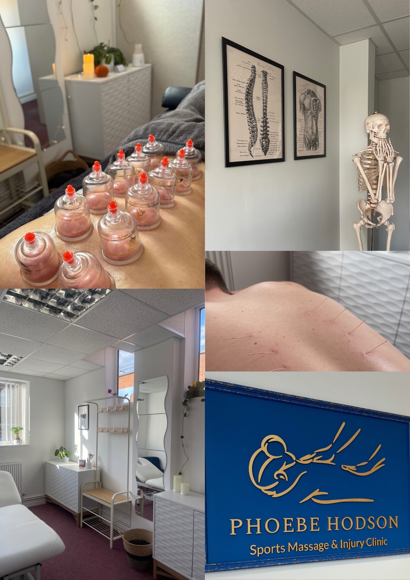 Phoebe Hodsons Sports Therapy